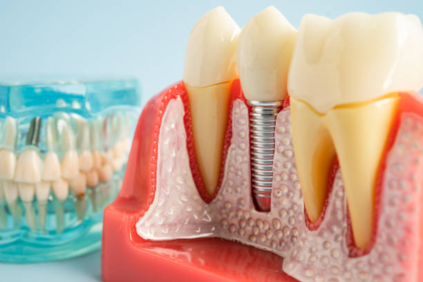 Our Range of Dental Services in South El Monte, CA